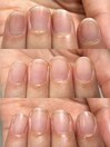 お客様Beforeafter 3か月