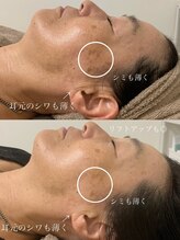 ニコ(25)/ラミピール