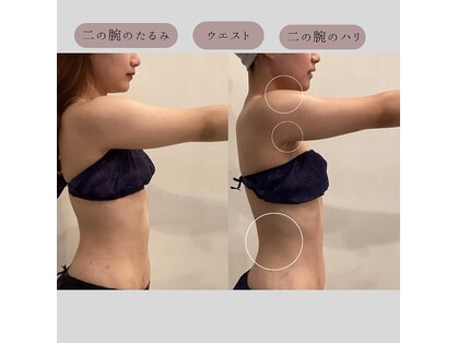 ラヴニール(L'avenir)の写真