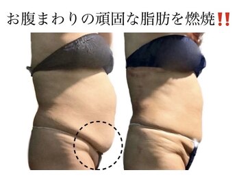 痩身革命 大宮店/ダイエットリンパマッサージ