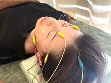 久心宝鍼灸院/通電美容鍼