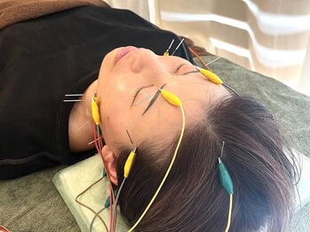 久心宝鍼灸院/通電美容鍼