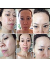 リュミエール(Lumie're)/オーナーの過去