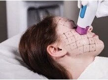 シラハタ(SHIRAHATA)/サーマリフト