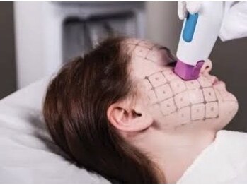 シラハタ(SHIRAHATA)/サーマリフト