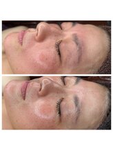 サロン ド マーシャ(salon de Marsha)/疲れ顔とは凹み