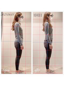 あんず美容整体サロン/◆姿勢症例◆