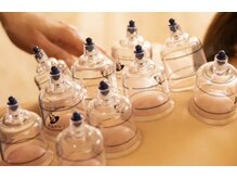 フェイス 72 トーキョー 浅草橋(Faith 72 TOKYO)/韓国式カッピングで代謝アップ