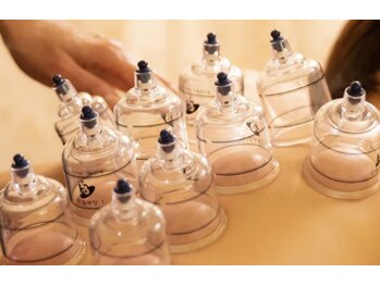 フェイス 72 トーキョー 浅草橋(Faith 72 TOKYO)/韓国式カッピングで代謝アップ