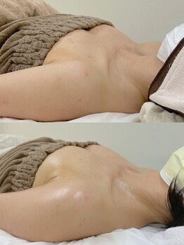 ワイサロン(Y salon)/40代/産後バストアップ/4ヶ月