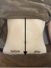 ミント(M’int)/お腹の効果写真