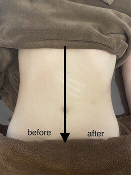 ミント(M’int)/お腹の効果写真