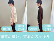 さいとう整骨院/猫背矯正が得意です！