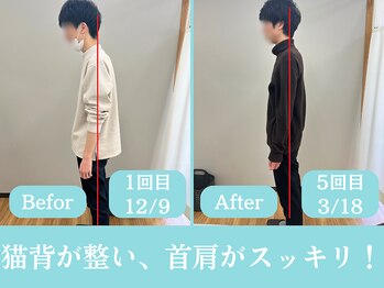さいとう整骨院/猫背矯正が得意です!