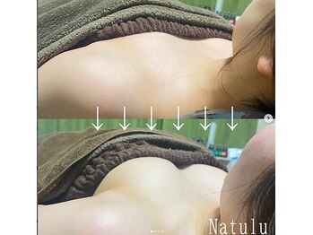 ナチュウル(Natulu)/ボンボンバスト