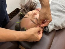 血流向上を促しお顔のリフトアップ！ハリツヤ・トーンアップも！