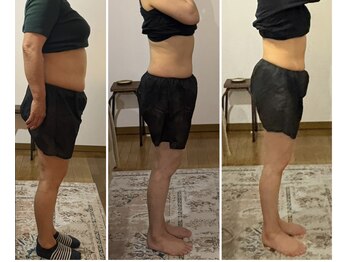 しあわせ腸研究所/腸もみbefore & after