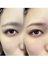 チルアンドアイ 千葉駅前店(Chill&Eye)/美眉スタイリング/BeforeAfter