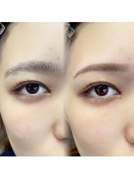 チルアンドアイ 千葉駅前店(Chill&Eye)/美眉スタイリング/BeforeAfter