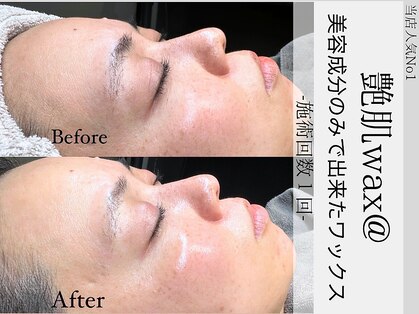 ウイ ネイルアンドビューティー(u'i nail&beauty)の写真