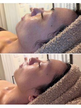 シグネット(Cygnet)/LDMリフティング