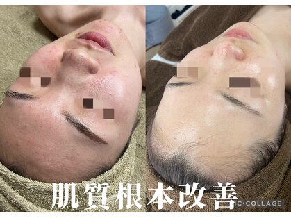 レイ(Lei)の写真