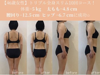 エターナルフレーム(Eternal Flame)/46歳　痩身スリム10回コース