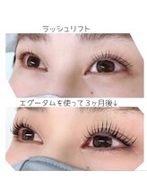 8(HACHI)/ラッシュリフト☆まつげパーマ