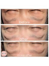 カイリ(Kaire)/ハリウッドブロウリフト