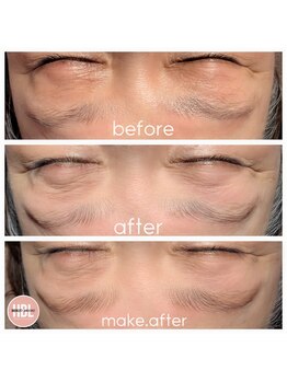 カイリ(Kaire)/ハリウッドブロウリフト