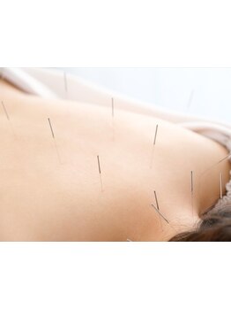 鍼灸施術を受けたい