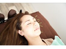 はぴねす鍼灸院/