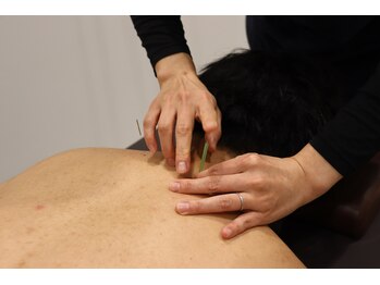 さくら整体院 屏風浦院/鍼灸施術で肩こり解消