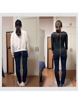 晴れ晴れ整体院/ブライダルで少しでも綺麗な姿を