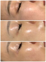 ラグ(LUXU)/ラミネーションピール