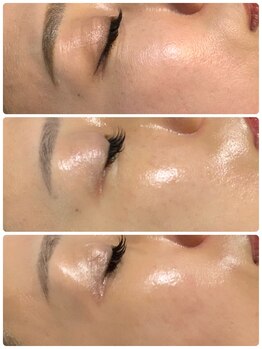 ラグ(LUXU)/ラミネーションピール