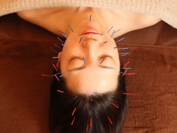 のはり/美容鍼灸