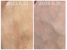 フォーチューン/よもぎ蒸し