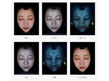 メルト 中目黒(Melt.)/＊AI肌診断機