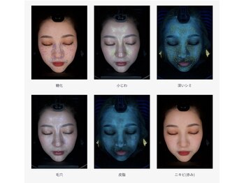 メルト 中目黒(Melt.)/*AI肌診断機