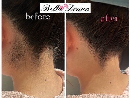 ベラドンナ(BellaDonna)の写真