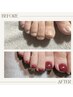 【深爪の方必見！】foot深爪矯正★ワンカラー　¥14000