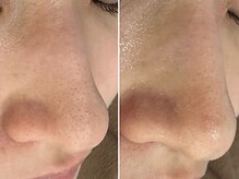 ケアナ 梅田店(CareNa)/メンズの清潔感ここにあり