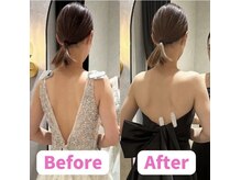 ボディキュア ブライダル美容整体 大阪梅田/憧れの肩甲骨に、、、！/梅田