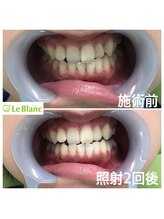 ルブラン 奈良店(Le Blanc)/お盆も休まず営業致します！