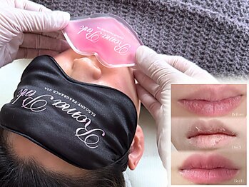 ノーブル(NOBLE)/ローマピンク大阪/黒ずみケア