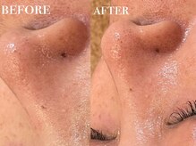 メナードフェイシャルサロン 中萩