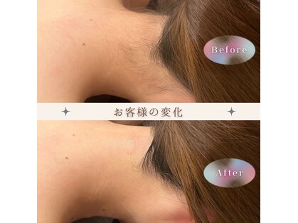 モア トゥインクル 緑井店(MORE twinkle)の写真