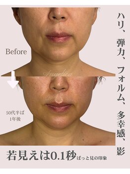 アンジェリカ(Angelica)/若見えはハリ/弾力/フォルム