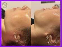 ヴィオール 名古屋栄店(VIOR)/パッと明るいくっきりフェイス♪